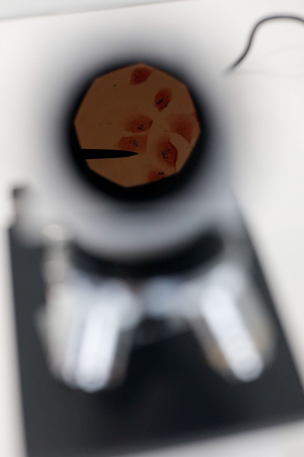 Vista de partículas en un microscopio.