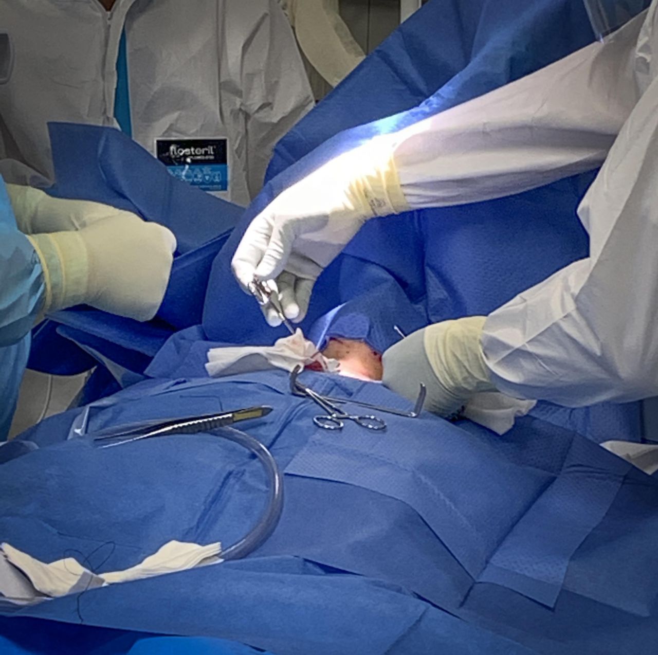 Primera intervención quirúrgica en el hospital público Enfermera Isabel Zendal a una paciente con coronavirus ingresada en la UCI