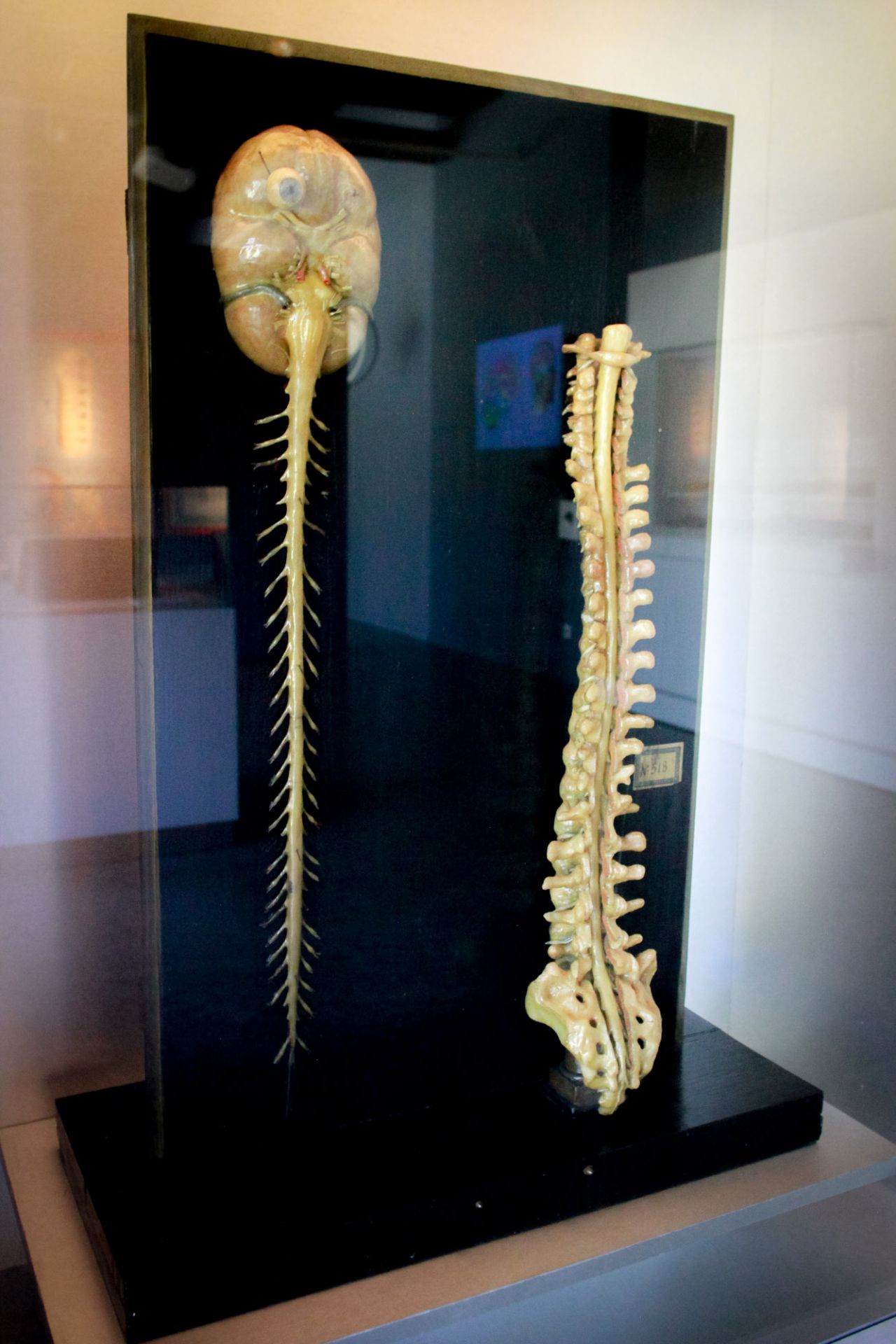 Ceras de la médula espinal.