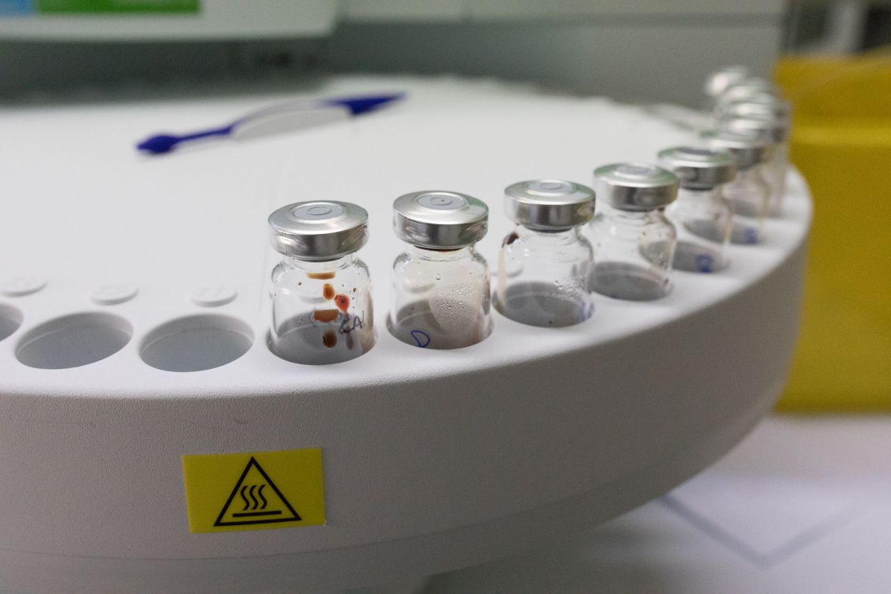 Muestras a analizar en el laboratorio.