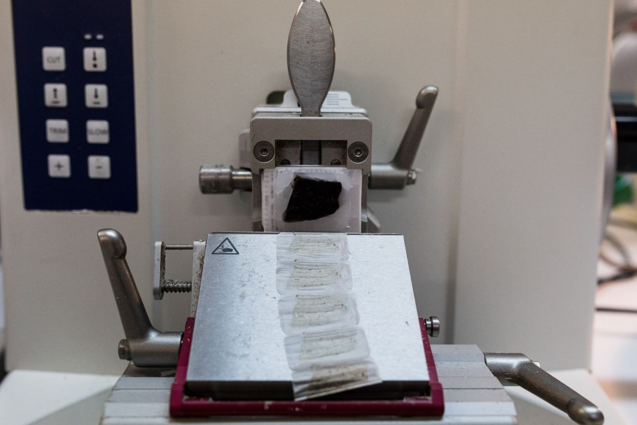 Máquina para extraer muestras en micras.