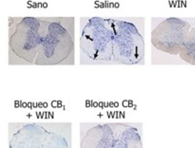 Cannabinoides para mejorar la esclerosis múltiple
