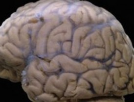 Detectan áreas dañadas al inicio del deterioro cognitivo