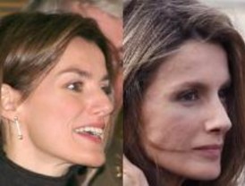 La Princesa de Asturias se opera la nariz