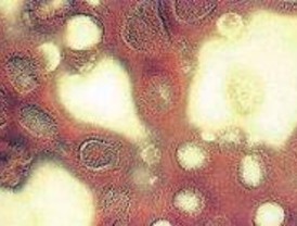 Descubierto uno de los mecanismos que el virus de la gripe usa para dañar células