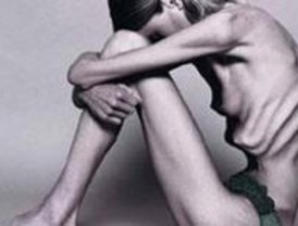 198 ingresos por anorexia y bulimia en un año, casi todos menores