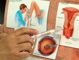 40.000 mujeres serán informadas del cáncer de cérvix