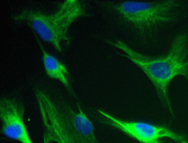 Una fuente inagotable de células para estimular la regeneración nerviosa