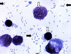 Bacterias probióticas contra la mastitis humana