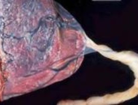 El primer banco privado de cordón umbilical abrirá sus puertas en marzo