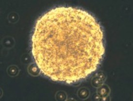 Hallan una proteína que elimina las células malignas de un tumor cerebral