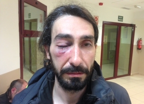 Kike Rincón, fotógrafo de Madridiario, herido en los disturbios