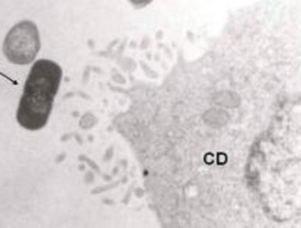 Nuevo tratamiento de la mastitis en mujeres lactantes