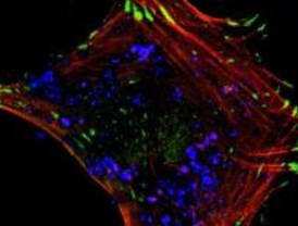 Investigación en biomateriales para prótesis articulares