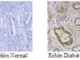 Descubren cómo afecta la glucosa al riñón