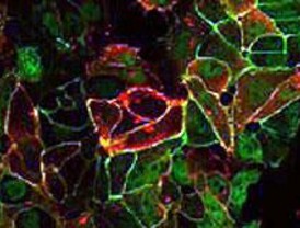 Vitamina D: nuevo mecanismo protector frente al cáncer de colon