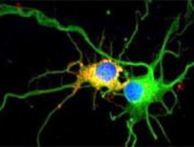 Se descubren nuevos datos sobre el origen de la epilepsia de Lafora