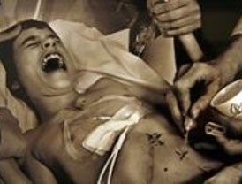 Retiro acoge una exposición sobre el cáncer infantil