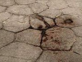 La niña de 18 meses herida de bala tiene dañado el cerebro