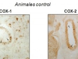 Papel de las Ciclooxigenasas en la disfunción eréctil