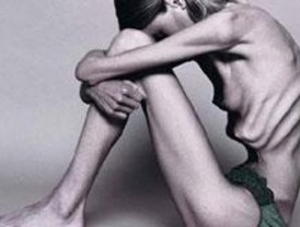 El 50% de las llamadas al teléfono de nutrición son por casos de anorexia