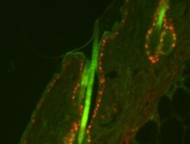 Nuevas tecnologías para identificar genes causantes del cáncer