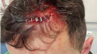 Prisión provisional para uno de los detenidos en la pelea entre policías y dominicanos de Tetuán