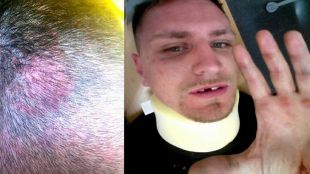 Denuncian que el 'salto' del antitaurino en Las Ventas termina en "brutal paliza"