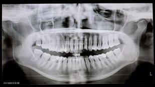 El PSOE llevará la ley de salud bucodental a Pleno pese a las discrepancias del Gobierno