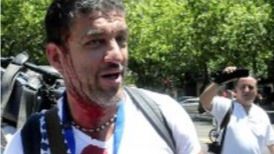 Piden dos años de prisión para un fotoperiodista acusado de atentado contra la autoridad