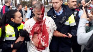 Las imágenes y los vídeos más brutales del referéndum en Cataluña