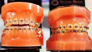 La transformación tecnológica, protagonista de Expodental