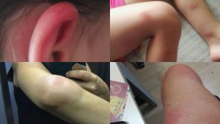 Madrid admite la presencia de mosca negra en Butarque