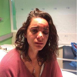 Una estudiante estadounidense, agredida y violada en Aluche