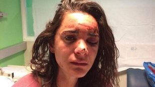 La joven ha publicado un duro relato de lo ocurrido en su cuenta de Facebook