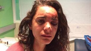 La joven ha publicado un duro relato de lo ocurrido en su cuenta de Facebook.