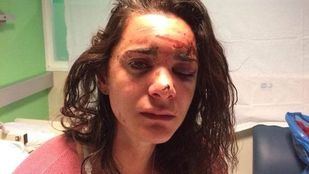 La estudiante violada en Aluche recauda fondos para víctimas