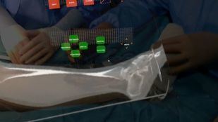 Realidad aumentada en quirófano gracias a un sistema pionero del Gregorio Marañón