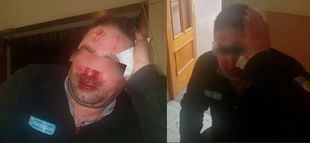 Un grupo de unos 20 menores del centro la emprendieron a patadas y puñetazos con los dos vigilantes