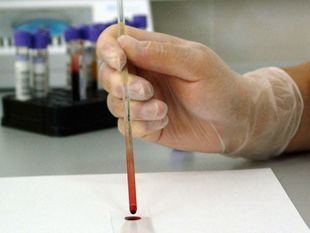 Seis posibles casos de listeriosis registrados en Madrid