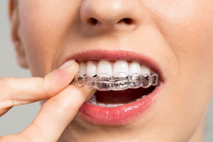 Seguro dental: por qué es tan importante contratar uno