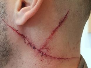 Detenido por rajar en el cuello a un GEO en una discusión de tráfico