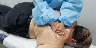 Fisioterapeutas ciegos se adaptan doblemente a su actividad en la reapertura post-Covid