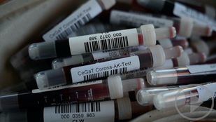 La pandemia supera los 25 millones de contagios