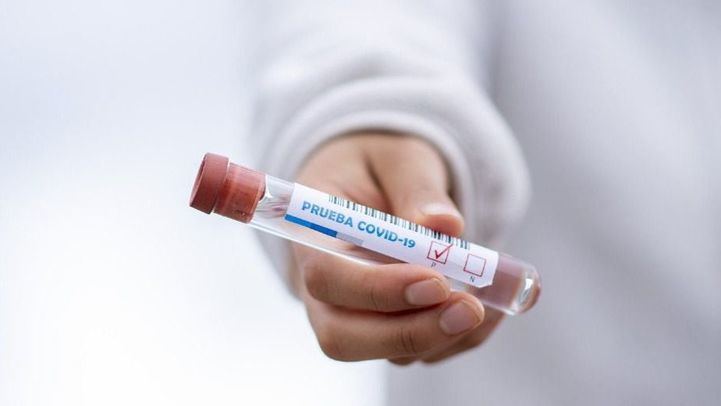 Madrid suma 2.731 casos nuevos de coronavirus, 1.602 de las últimas 24 horas, y 34 fallecidos