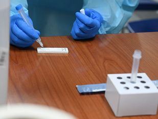 Se mantiene al alza la cifra de fallecidos diarios por coronavirus: 63 en las últimas 24 horas