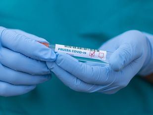 Los contagios y las hospitalizaciones por Covid mantienen su tendencia decreciente