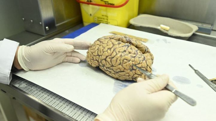 Uno de os cerebros donados al banco de tejido cerebral de la Fundación Cien.