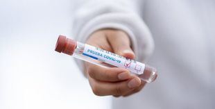 El descenso de nuevos positivos y presión asistencial se estanca en Madrid