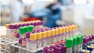 Los hospitales madrileños necesitan con urgencia sangre de los grupos 0-, 0+ y A-